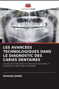 Produktbild: Les Avanc&eacute;es Technologiques Dans Le Diagnostic des Caries Dentaires