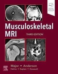 Produktbild: Musculoskeletal MRI