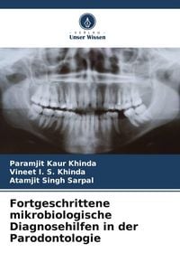 Produktbild: Fortgeschrittene mikrobiologische Diagnosehilfen in der Parodontologie