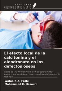 Produktbild: El efecto local de la calcitonina y el alendronato en los defectos &oacute;seos