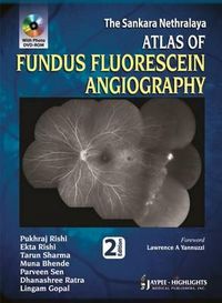Produktbild: Atlas of Fundus Fluorescein Angiography