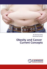 Produktbild: Obesity and Cancer Current Concepts