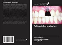 Produktbild: Fallos de los implantes