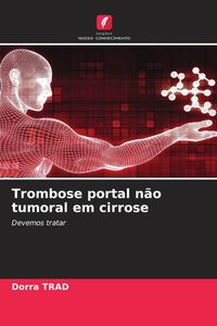 Produktbild: Trombose portal n&atilde;o tumoral em cirrose