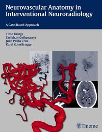 Produktbild: Neurovascular Anatomy in Interventional Neuroradiology