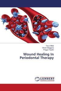Produktbild: Wound Healing In Periodontal Therapy