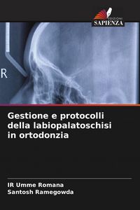 Produktbild: Gestione e protocolli della labiopalatoschisi in ortodonzia