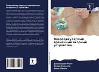 Produktbild: Vneradikulqrnye wremennye qkornye ustrojstwa