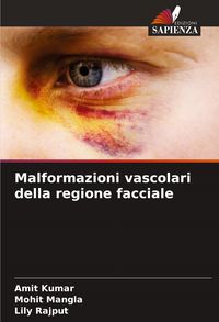 Produktbild: Malformazioni vascolari della regione facciale