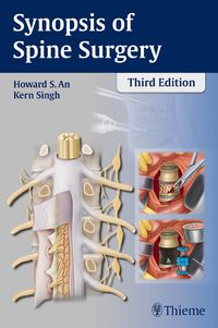 Produktbild: Synopsis of Spine Surgery