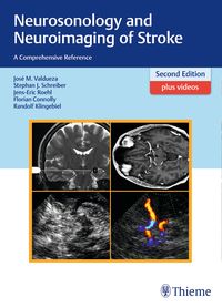 Produktbild: Neurosonology and Neuroimaging of Stroke
