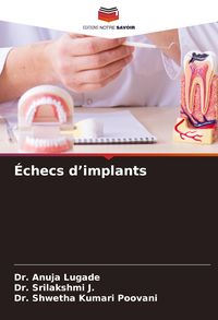 Produktbild: &Eacute;checs d'implants