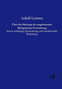 Produktbild: &Uuml;ber die Heilung der angeborenen H&uuml;ftgelenks-Verrenkung