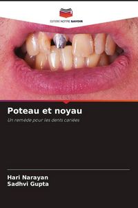 Produktbild: Poteau et noyau