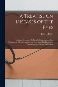 Produktbild: A Treatise on Diseases of the Eyes; Including Diseases of the Eyelids, Inflammations of the Conjunctiva, Sclerotica and Cornea; Also, Catarrhal, Rheum