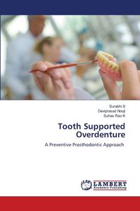 Produktbild: Tooth Supported Overdenture