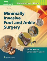 Produktbild: Bluman, E: Minimally Invasive Foot & Ankle Surgery