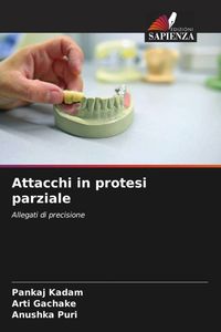 Produktbild: Attacchi in protesi parziale