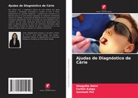 Produktbild: Ajudas de Diagn&oacute;stico de C&aacute;rie