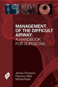 Produktbild: Management of the Difficult Airway