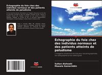 Produktbild: &Eacute;chographie du foie chez des individus normaux et des patients atteints de paludisme