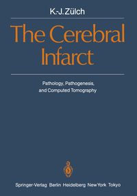 Produktbild: The Cerebral Infarct