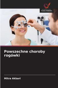 Produktbild: Powszechne choroby rog&oacute;wki