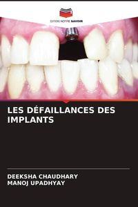 Produktbild: Les D&eacute;faillances des Implants