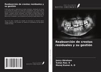 Produktbild: Reabsorci&oacute;n de crestas residuales y su gesti&oacute;n