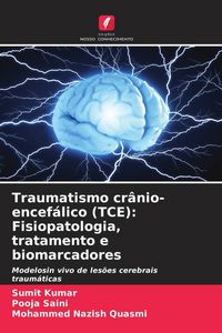 Produktbild: Traumatismo cr&acirc;nio-encef&aacute;lico (TCE): Fisiopatologia, tratamento e biomarcadores