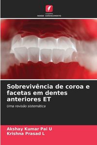 Produktbild: Sobreviv&ecirc;ncia de coroa e facetas em dentes anteriores ET