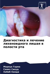 Produktbild: Diagnostika i lechenie lihenoidnogo lishaq w polosti rta