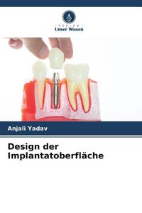 Produktbild: Design der Implantatoberfl&auml;che