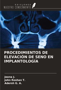Produktbild: Procedimientos De Elevaci&oacute;n De Seno En Implantolog&iacute;a