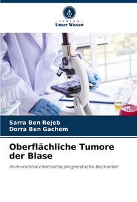 Produktbild: Oberfl&auml;chliche Tumore der Blase