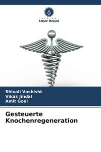 Produktbild: Gesteuerte Knochenregeneration