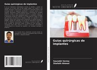 Produktbild: Gu&iacute;as quir&uacute;rgicas de implantes