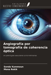 Produktbild: Angiograf&iacute;a por tomograf&iacute;a de coherencia &oacute;ptica