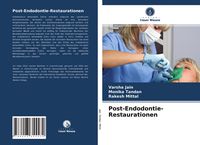 Produktbild: Post-Endodontie-Restaurationen