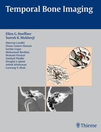 Produktbild: Temporal Bone Imaging