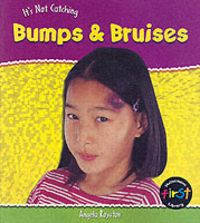 Produktbild: Bumps and Bruises