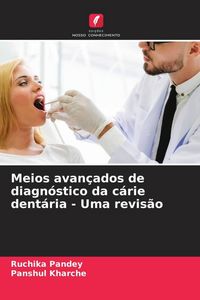 Produktbild: Meios avan&ccedil;ados de diagn&oacute;stico da c&aacute;rie dent&aacute;ria - Uma revis&atilde;o