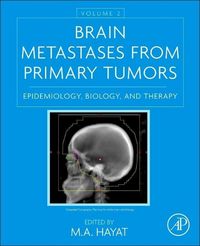 Produktbild: Brain Metastases from Primary Tumors, Volume 2