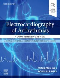 Produktbild: Electrocardiography of Arrhythmias: A Comprehensive Review