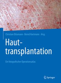 Produktbild: Hauttransplantation