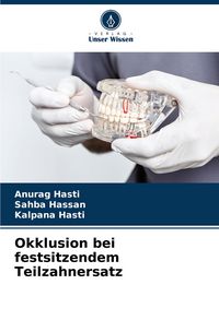 Produktbild: Okklusion bei festsitzendem Teilzahnersatz
