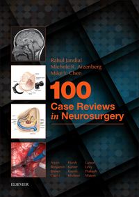 Produktbild: 100 Case Reviews in Neurosurgery E-Book