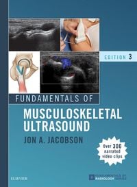 Produktbild: Fundamentals of Musculoskeletal Ultrasound E-Book
