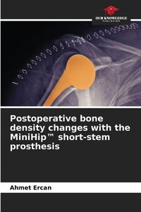 Produktbild: Postoperative bone density changes with the MiniHip(TM) short-stem prosthesis