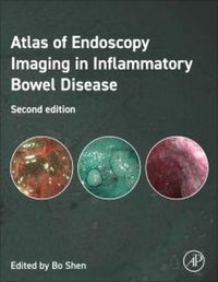 Produktbild: Atlas of Endoscopy Imaging in Inflammatory Bowel Disease